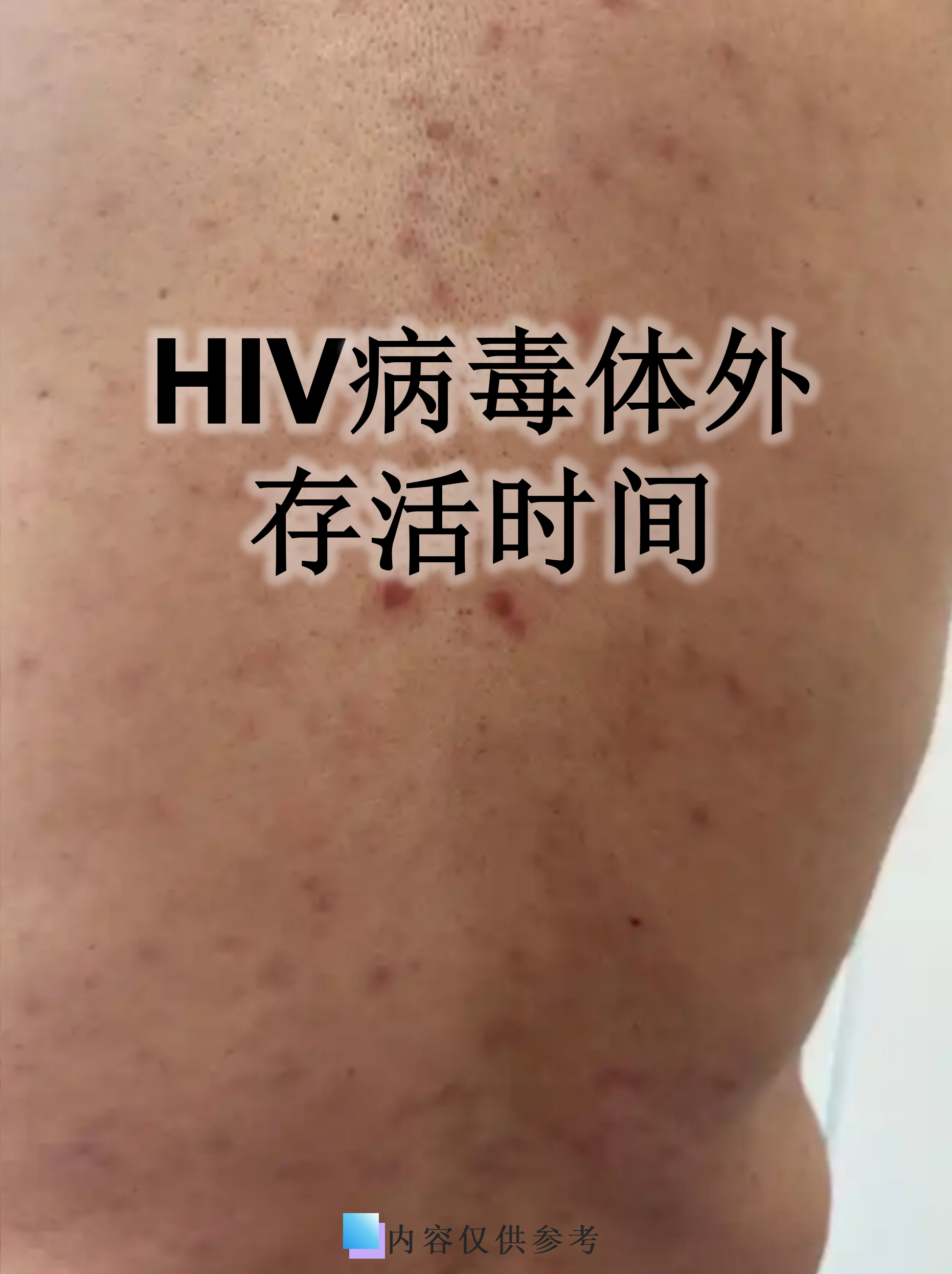 南京德尔塔病毒,南京德尔塔病毒有多厉害-第2张图片