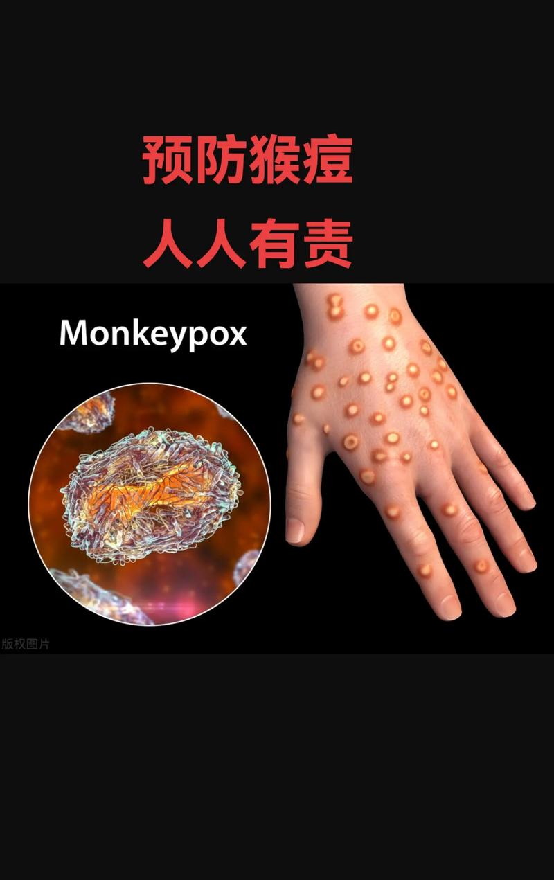 河南最新的疫情︰(河南最新疫情2025)-第1张图片