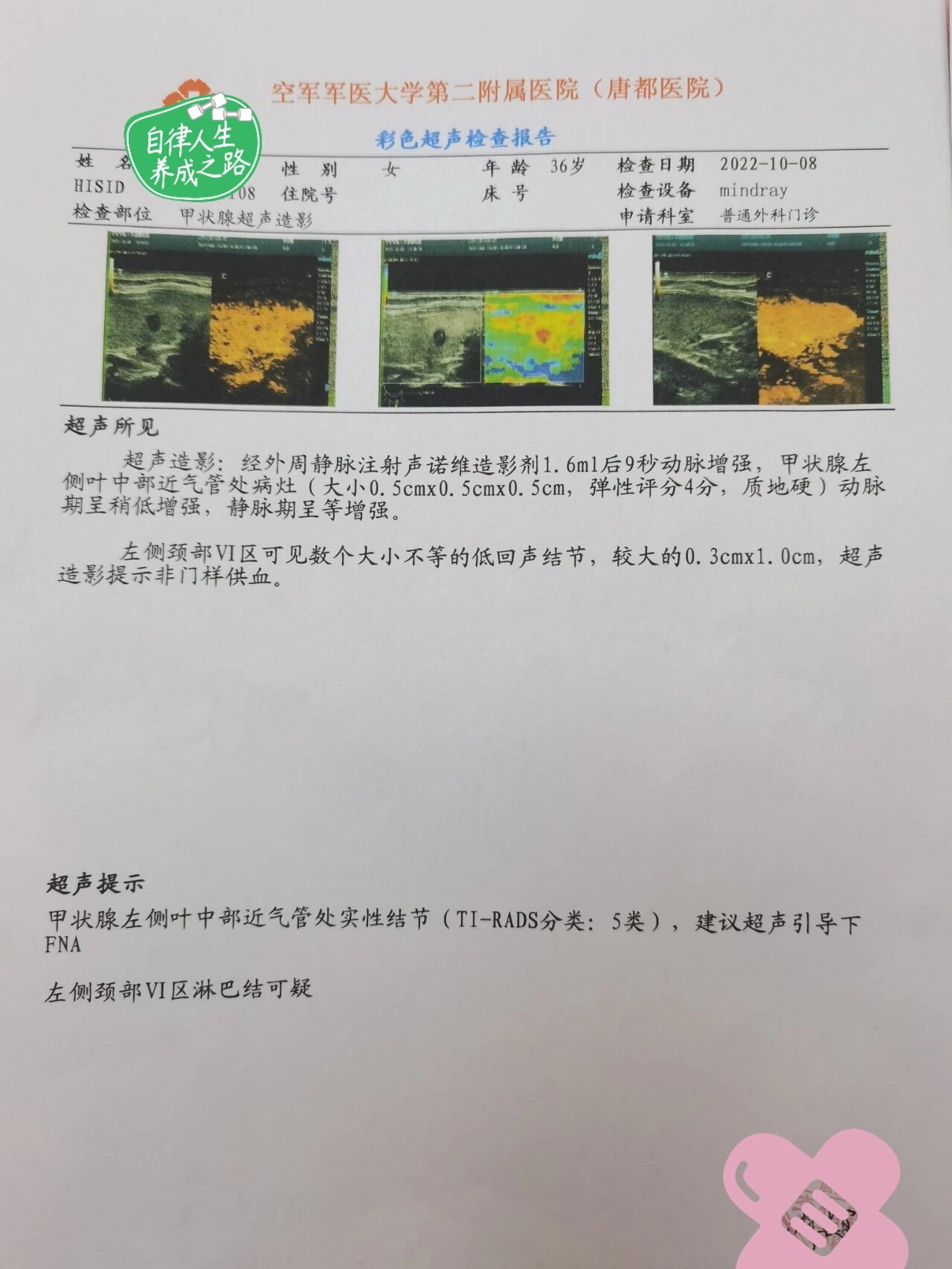 警惕!西安已多人确诊!︰(西安又确诊一例)-第3张图片